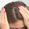 Dandruff Tips: చుండ్రు సమస్యతో జుట్టు ఊడిపోతుందా? ఈ టిప్స్‌తో సమస్యకు చెక్..