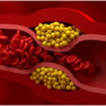 Bad Cholesterol : చెడు కొలెస్ట్రాల్ను కరిగించే చిట్కా.. మన ఇంట్లోనే..!