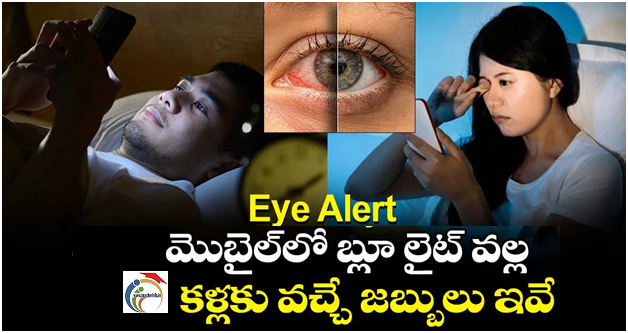 Eye Alert : మొబైల్⁬ ఎక్కువ చూడటం వల్ల కళ్లకు వచ్చే జబ్బులు ఇవే